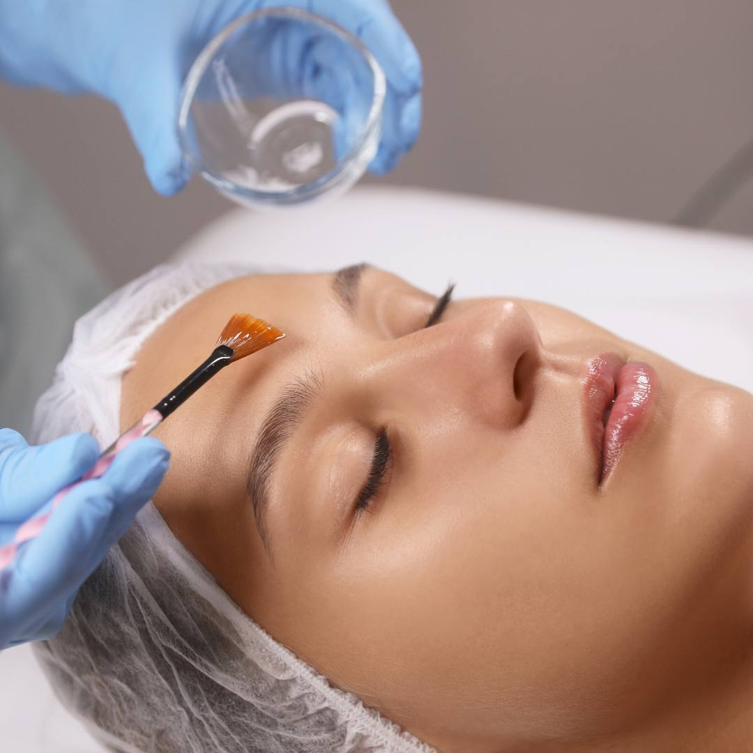 L4 Skin Peeling Course